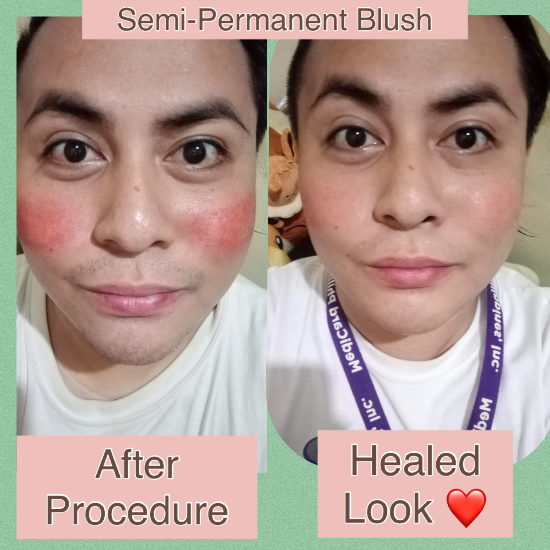 Semi-Permanent Cheek Blush Online Training